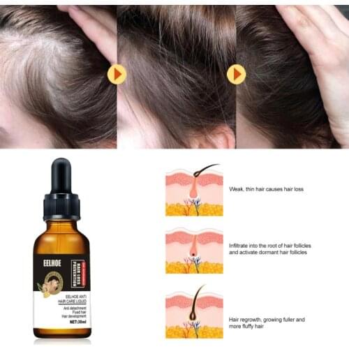 Eelhoe Plant Anti-hair Loss Hair Growth Essence Oil Hair Growth Liquid Anti-hair Loss Care Product Treatment For Men Women