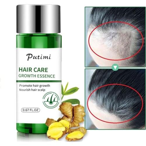 Hair Growth Essential Oil Fast Promoting Hair Growth Essence Prevent Baldness Nourish Scalp Anti Hair Loss Product for Man Women