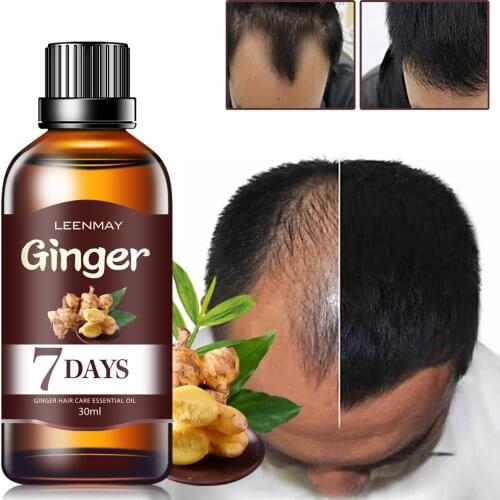 Hair Growth Ginger Bundles Hair Care Hair Oil for Fast Hair Growth Hair Growth Serum Hairline Castor Oil for Hair Growth