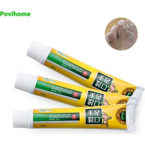 3pcs Anti-chapping Cream Anti-fungal Peeling Repair Anti Dry Crack Ointment Moisturizing Itch Blisters Natural Skin Care P1183