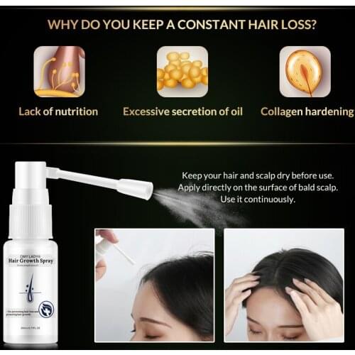 Hair Growth Fluid Hair Growth Ointment Hair Growth Essence 20ml Fashion Effective for OMY LADY Increase Nutrition Fast