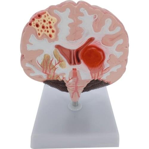 2021 New Human Brain Model Brain Anatomical Model with Cerebral Cortex Brain Stem Arteries Etc for education Lectures Use