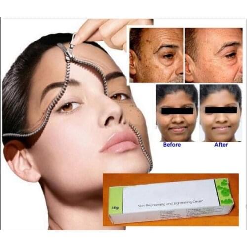 15g/30g Melaglow New Brightening Whitening Cream, 40% Licorice Extract Niacinamide Antioxidant