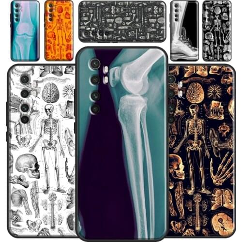 X-Ray Human Anatomy Case For POCO M3 Pro F3 POCO X3 Pro Cover For Xiaomi Mi 11 Ultra 9T 10T Pro Note 10 Lite