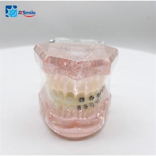Dental Teeth Model M3003 Model with Metal and Ceramic Bracket