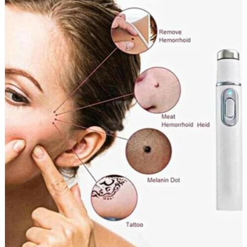 Acne Laser Pen Skin Spots Removal Pen Anti Varicose Spider Vein Eraser Treatment Portable Medical Blue Light Therapy Laser Pen