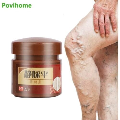 1Pcs 20g Original Varicose Veins Treatment Cream Vasculitis Phlebitis Ointment Spider Remove Pain Relief Plaster Health Care
