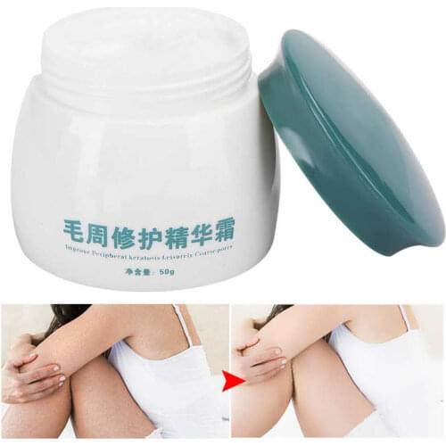 Professional Keratosis Pilaris Cream Body Soothing Chicken Skin Treatment Body Care Cream 50g Body Scrub Cream