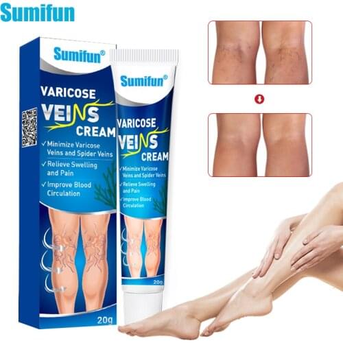 Sumifun Varicose Veins Treatment Cream Phlebitis Varicosity Angiitis Plaster Spider Leg Ointment For Relief Leg Pain Numbness