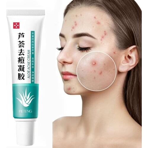 Acne Aloe Vera Gel Acne Cream Cream Sleep Moisturizing Disposable Mask Aloe Gel Lotion Facial Skin Care