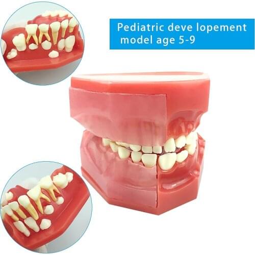 Deciduous Teeth and Permanent Teeth Alternative Model Children Show Eruption and Development of Deciduous and Permanent Teeth
