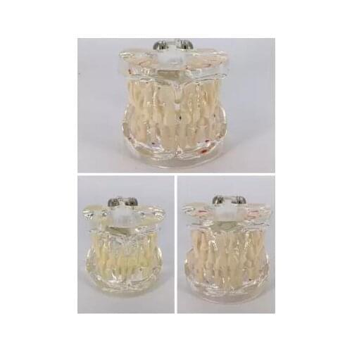 Tooth model Childrens baby teeth transparent model Permanent tooth alternant pathological models free shipping