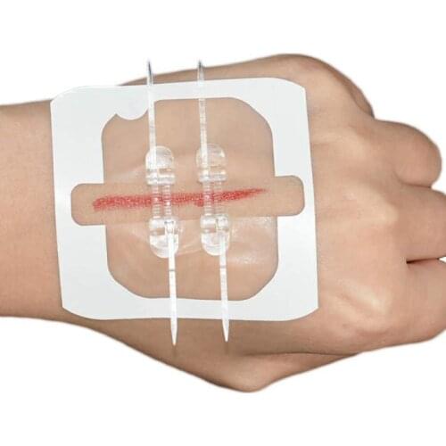 1pcs Bandage Band Aid Zip Stitches Zip Tie Wound Closure Adhesive Suture-free Without Needles Suture-free Wound Dressing Patch