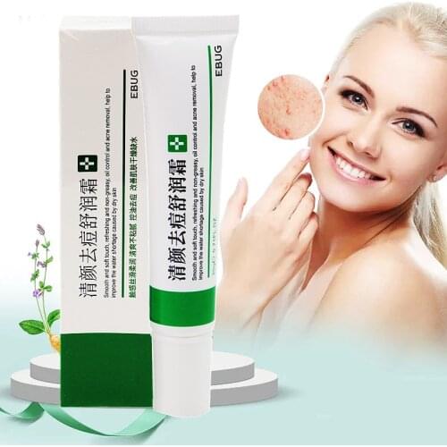 Effective Acne Removal Cream Acne Treatment Fade Acne Spots Oil Control Shrink Pores Whitening Moisturizing Acne Cream Skin Care