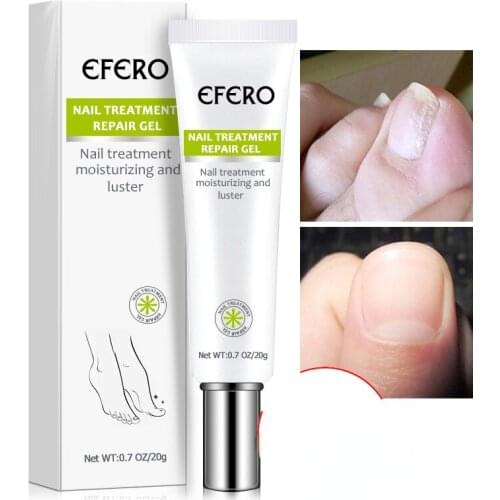Fungal Nail Treatment Serum Nail Foot Nail Fungus Removal Gel Anti Infection Onychomycosis Nail Repair Essence Cream TSLM1