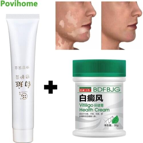 Vitiligo Leukoplakia Disease Treatment Ointment White Spot Disease Repair Cream Chinese Medical Pigment Melanin Skin Care Balm