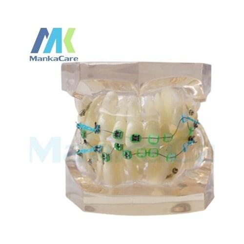 Manka Care - 24 pcs Tooth,half metal&half ceramic bracket Oral Model Teeth Tooth Model