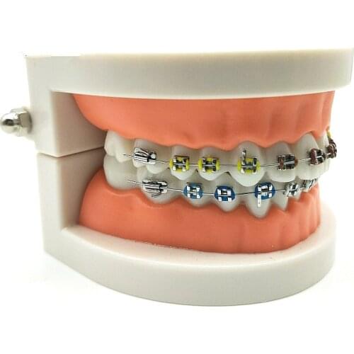 1 Pcs Dental Orthodontic Treatment Model With Ortho Metal Ceramic Bracket Arch Wire Buccal Tube Ligature Ties