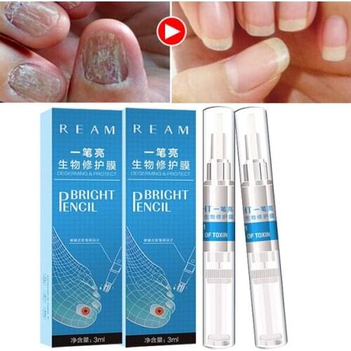 New 3ml Nail Fungus Treatment Liquid Toenail Anti Fungal Nails Care SCI88