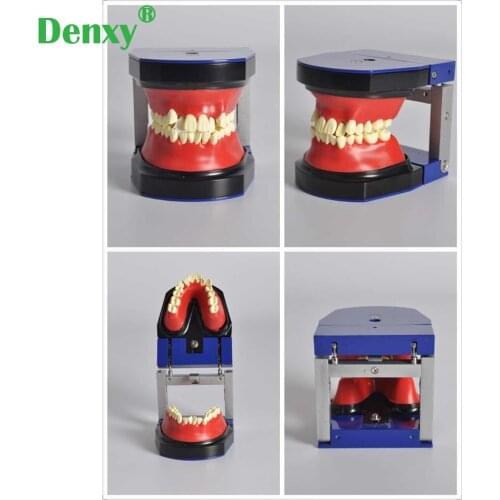 Denxy Dental Orthodontic Treatment Model Typodont Study Teeth Model Metal Ceramic Bracket Arch Wire Buccal Tube Ligature Ties