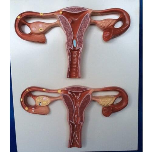 Female Uterus Anatomy Model Pregnancy Model Fertilization Process Sperm In The Uterus Combined Development Process Model Ovary