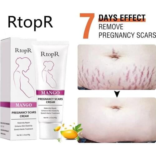 DJBS Cream For Stretch Marks