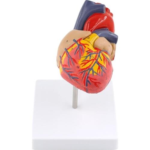 1:1 Human Heart Anatomical Model ultrasound color Doppler ultrasound detachable big heart teaching model