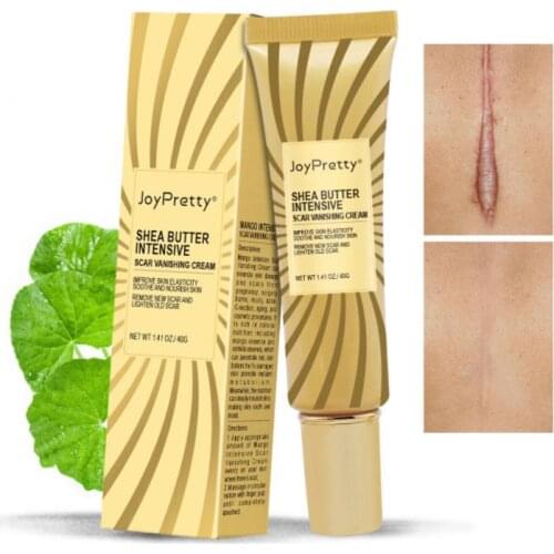 40g Acne Scar Removal Cream Caesarean Hyperplasia Scar Repair Gel Scar Cream Stretch Marks Scar Skin Care TSLM1