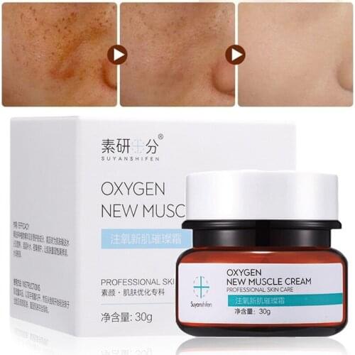 Skin Care Freckle Cream Anti Aging Whitening Cream Freckle & Dark Spot Removal Cream Face Moisturizing Lightening Cream 30g