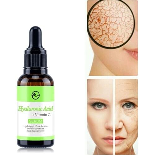 Minch Pure Vitamin C Serum Hyaluronic Acid Essential Oil Facial Care Serum Whitening Lifting Sun Spot Anti Aging Wrinkle Oil