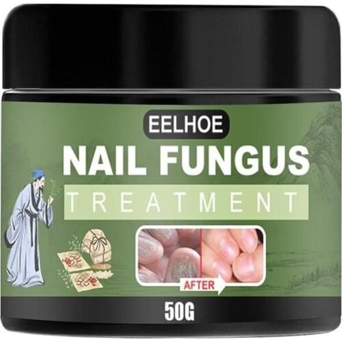 Anti Fungal Nail Infection Fingers Feet Nail Fungus Treatment Ointment Onychomycosis Antibacterial Cream Herbal Repair Cream