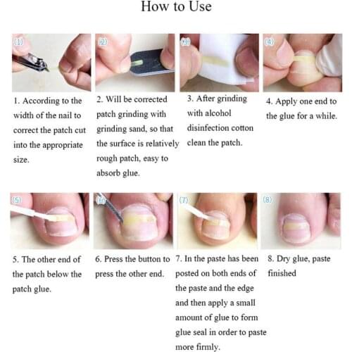 120pcs Ingrown Toe Nail Correction Sticker Ingrown Sticker Patch Foot Care