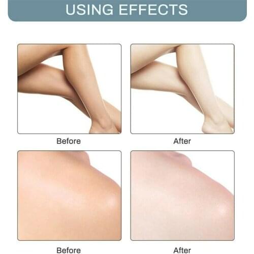 Skin Lightening Bleaching Cream for Underarm Dark Skin Legs Knees Whitening Intimate Body Lotion 60g,Armpit Whitening Cream