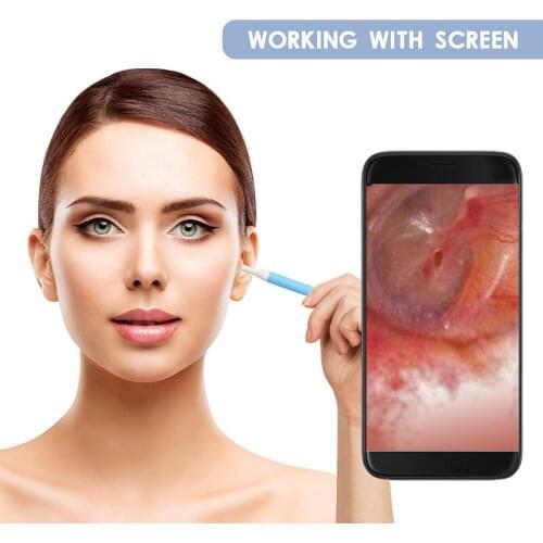 5.5mm Ear Otoscope Megapixels Ear Scope Inspection Camera 3 in 1 USB Ear Digital Endoscope Earwax Cleaner Tool with 6 Leds