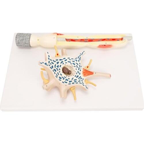 Neuron Enlargement Model Cell Body And Nerve Fiber Structure Enlarged Model Anatomy Medical Teaching Tools BIX-A1108