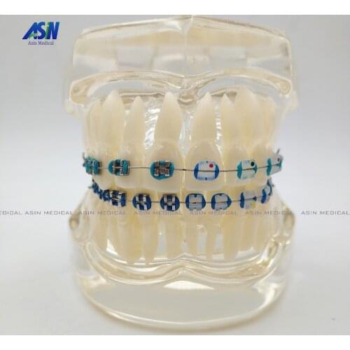 NEW Arrival Dental Orthodontics Typodont Teeth Model Half Metal Half Ceramic Brace bracket Typodont with Arch Wire