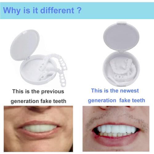 High Quality Second-generation Gel Silica Material Temporary Upper Lower Teeth Simulation Cover Whitening Set False Fake Tooth