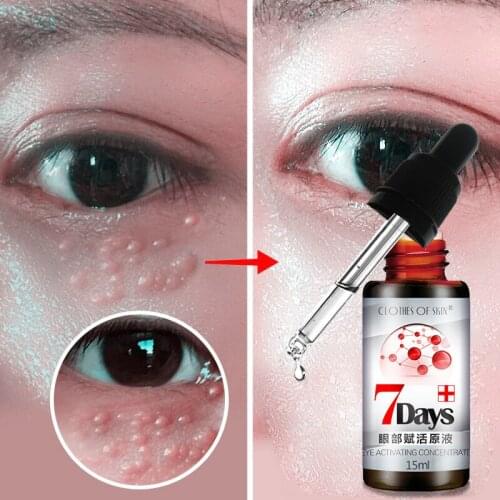 Eye Activating Concentrate Lighten Dark Circles In 7 Days Remove Eye Bags Fat Particles Eye Serum Anti-Wrinkle Anti Puffiness