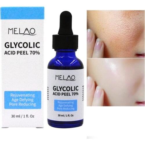 30ML Glycolic Acid Peel 70% Shrink Pores Brighten Skin Color Balance Water And Oil Improve Acne Skin Nourishing Skin Care
