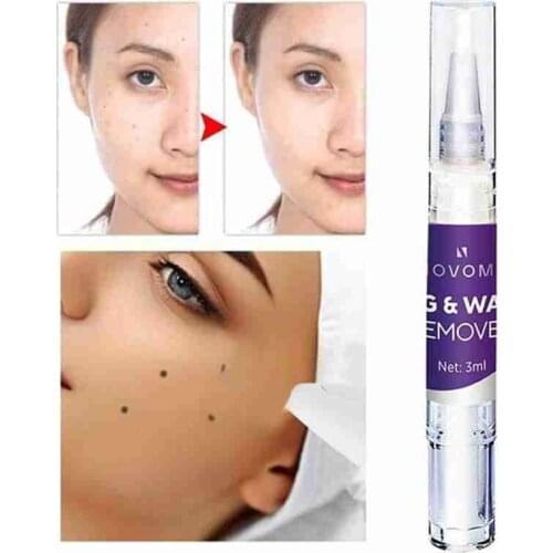 Skin Tag Remover Against Mole & Genital Wart Fast Remover Anti Genital Wart Acne Foot Corn Removal Warts Papillomas removes mole