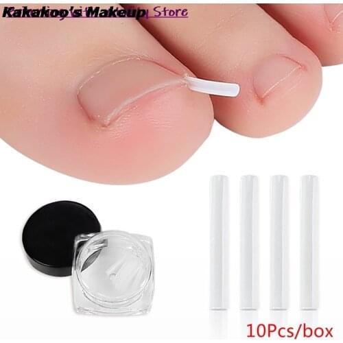 10pcs/pack Toenail Straightening Clip Ingrown Toenail Correction Tool Nail Treatment Elastic Patch Sticker Foot Care Pedicure
