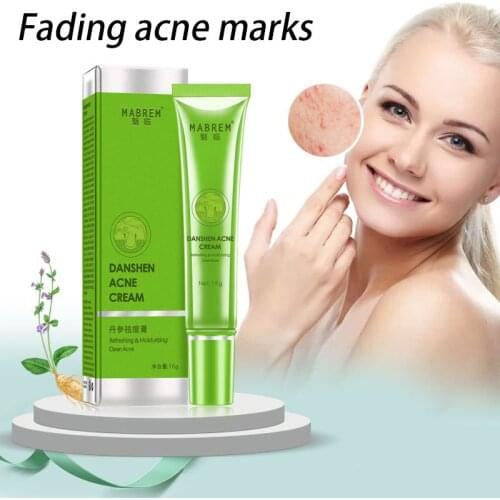 Acne Treatment Acne Scar Remover With Lavender Extract Spot Pimple Moisturizing Cream Replenish And Soothe Dry Skin 15g New