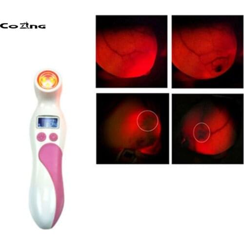 Therapeutic Device 650nm Cold Light Breast Analyzer Female Health Care Product