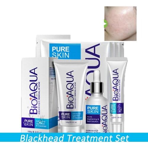 Anti Acne Shrink Pores Whitening Treatment Blackhead Scars Anti Acne Removal Gel Moisturizing Scar Face Care Set 4 pcs