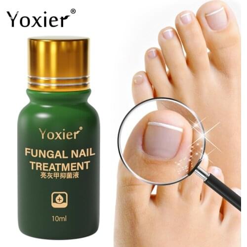 Yoxier Fungal Nail Treatment Antibacterial Serum Repair Rough Discolored Anti Infection Paronychia Onychomycosis Foot Care