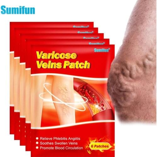 6pcs New Sumifun Varicose Veins Plaster Vasculitis Phlebitis Spider Cream Varicosity Angiitis Removal Herbal Medical Plasters