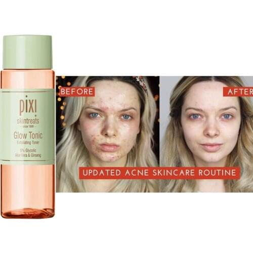 Pixi 100ML 5% Glycolic Acid Moisturizing Oil-controlling Lift Anti-acne Essence For Women Skin Care Facial Repair Makeup Toner