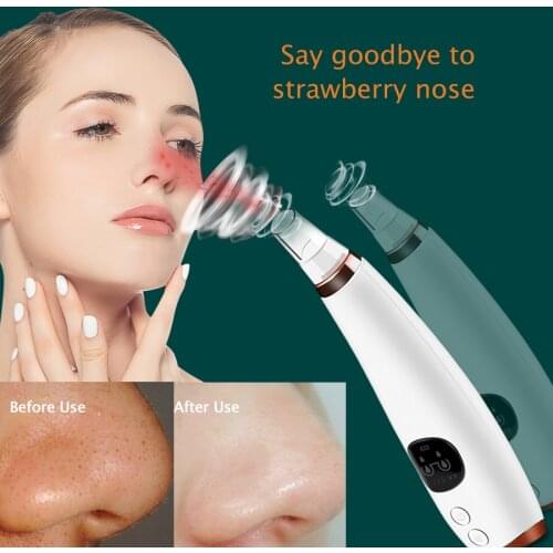 Suction Black Dots Blackheads Removal Pore Cleaner Facial Cleaning Against Blackhead Acne Remover Vacuum Pore Cleaner Tool