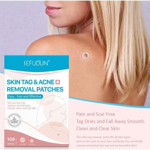 Skin and Acne Removal Patches Natural Skin Tag Removers for Face Skin Care 108PCS