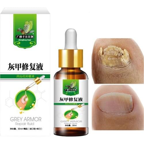 Fungal Nail Repair Essence Serum Treatment Care Foot Nail Fungus Removal Gel Anti Infection Paronychia Onychomycosis